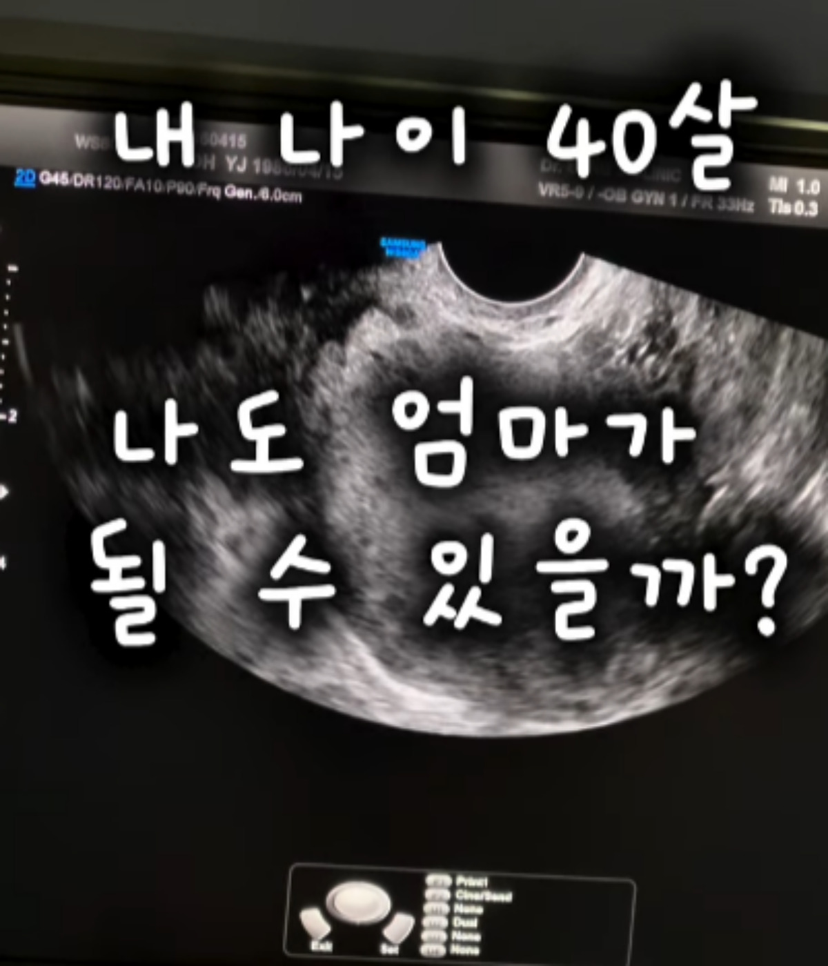 출처 : 오초희 SNS