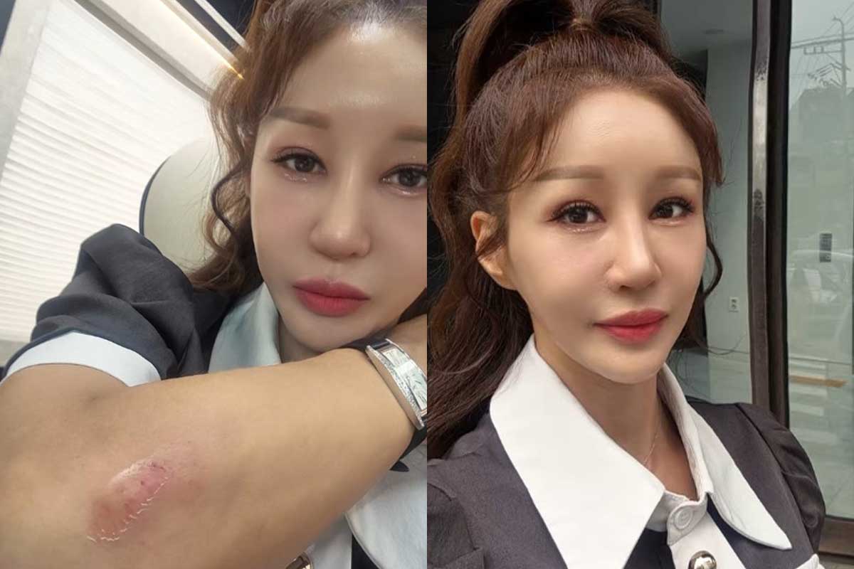 출처 : 김혜연 SNS