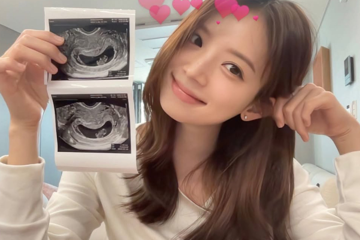 출처 : 김지영 SNS